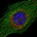 Mistero risolto: ecco come l&#039;HIV entra nel nucleo della cellula