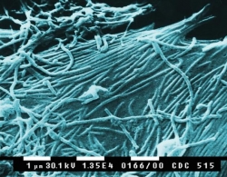 Ebola: il virus può trasmettersi sessualmente anche dopo la guarigione
