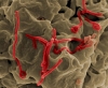 Ebola, i sintomi e le origini di un’emergenza internazionale