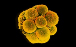 Creato per la prima volta embrione umano immune all&#039;HIV